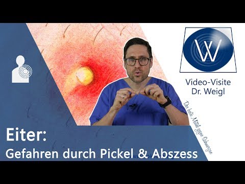 Eiter &amp; Bakterien im Pickel, Abszess oder Furunkel! Ist ausdrücken &amp; selbst entfernen gefährlich?🤔