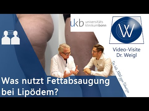 Lipödem &amp; dicke Beine durch Fettabsaugung für immer weg: Tipps &amp; OP-Erfahrungen mit Dr. Walgenbach