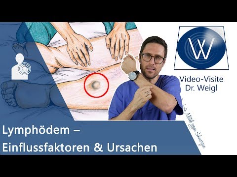 Lymphödem heilen durch Ernährung, Lymphdrainage oder Operation? Ursachen für dicke Beine &amp; Arme