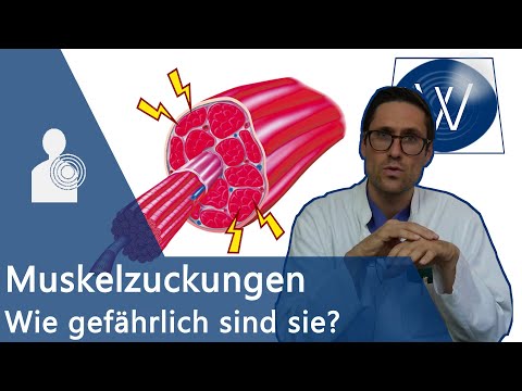 ALS? Muskelzuckungen &amp; Muskelzucken in Oberschenkel, Arm, Auge, Wade, Zunge | Ursachen Faszikulation