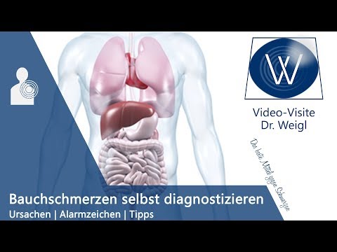 Bauchschmerzen Ursachen + Alarmzeichen // Bauchschmerzen rechts unten, links, oberbauch // Tipps