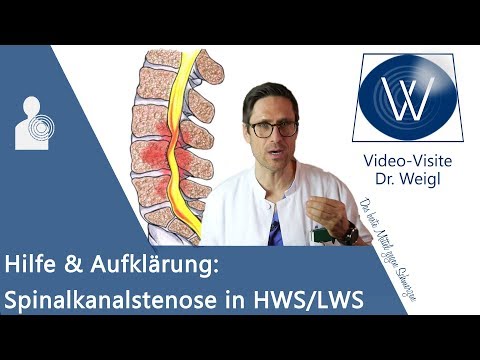 Spinalkanalstenose: Rückenschmerzen durch Spinalstenose in HWS/ LWS ⚡ Symptome, Gefahren &amp; Therapie
