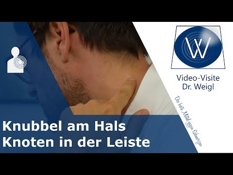 Knubbel hinterm Ohr, am Hals &amp; Knoten in der Leiste: Sind geschwollene Lymphknoten gefährlich?