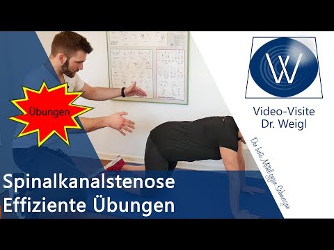 Richtige Hilfe 💡bei Rückenschmerzen durch Spinalkanalstenose ⚡ Die richtigen Übungen für zu Hause ✅