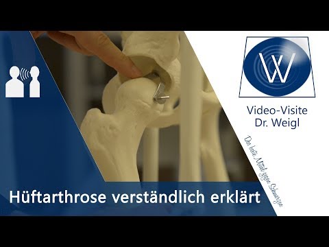 Hüftschmerzen ⚡ Was tun bei Hüftarthrose? Therapie &amp; Übungen bei Coxarthrose ✔ Schmerz lösen #4