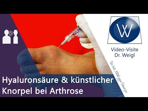 Helfen Hyaluronsäure &amp; Knorpel Transplantation bei Arthrose? Arthrose Therapie | Arthrose heilen?!