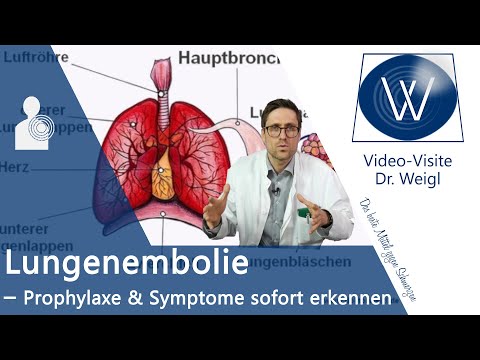 Lungenembolie ⚠ unbedingt vorbeugen &amp; schnell erkennen - Symptome, Behandlung &amp; Ursachen erklärt ✅