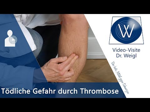 Die tödliche Gefahr durch Thrombose - Ursachen, Symptome &amp; Tipps bei tiefer Beinvenenthrombose (TVT)