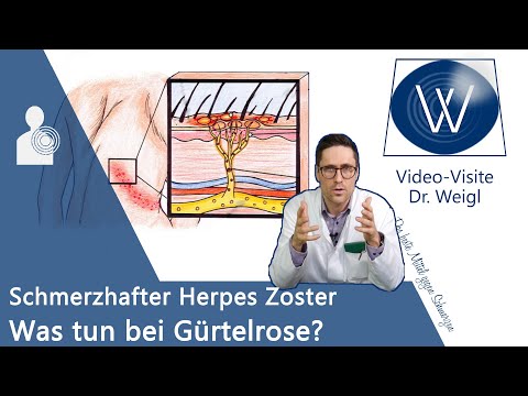 Herpes Zoster (Gürtelrose) durch Windpocken-Viren 😬 Schmerzen &amp; Ausschlag - Entstehung &amp; Therapie