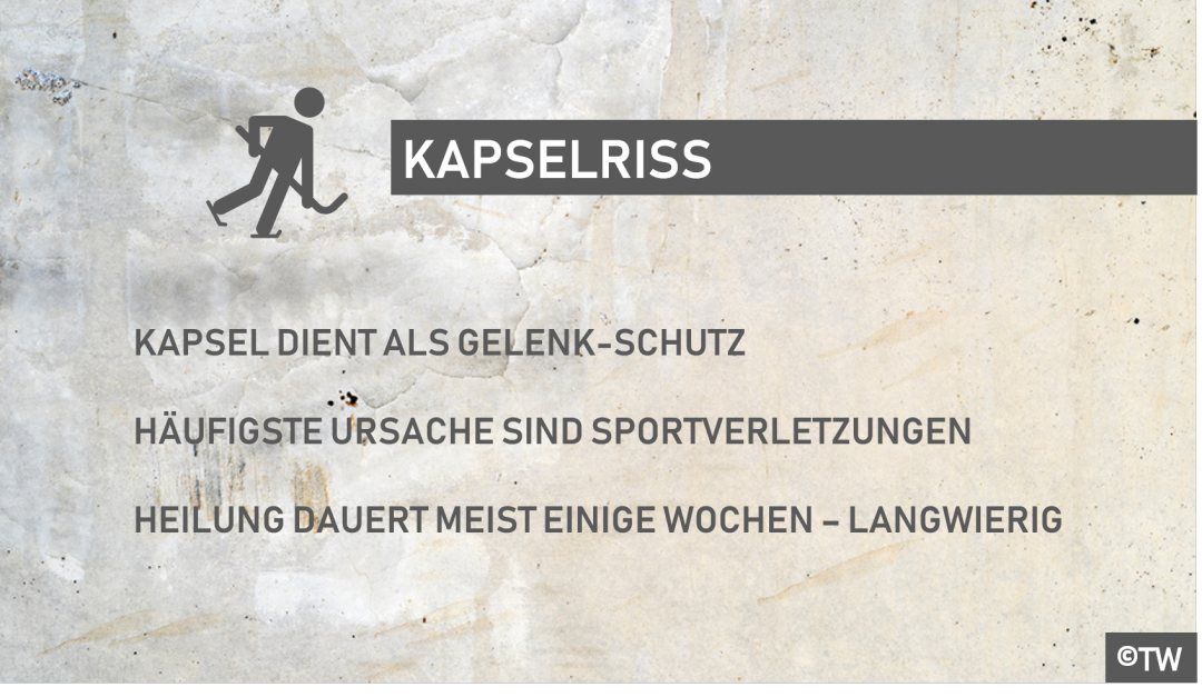 Zeh kapselriss Kapselriss Zeh