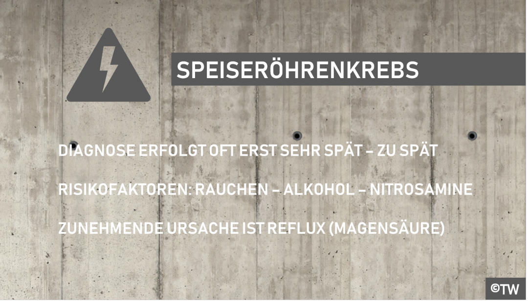 Doktorweigl Erklart Speiserohrenkrebs Speiserohrentumor