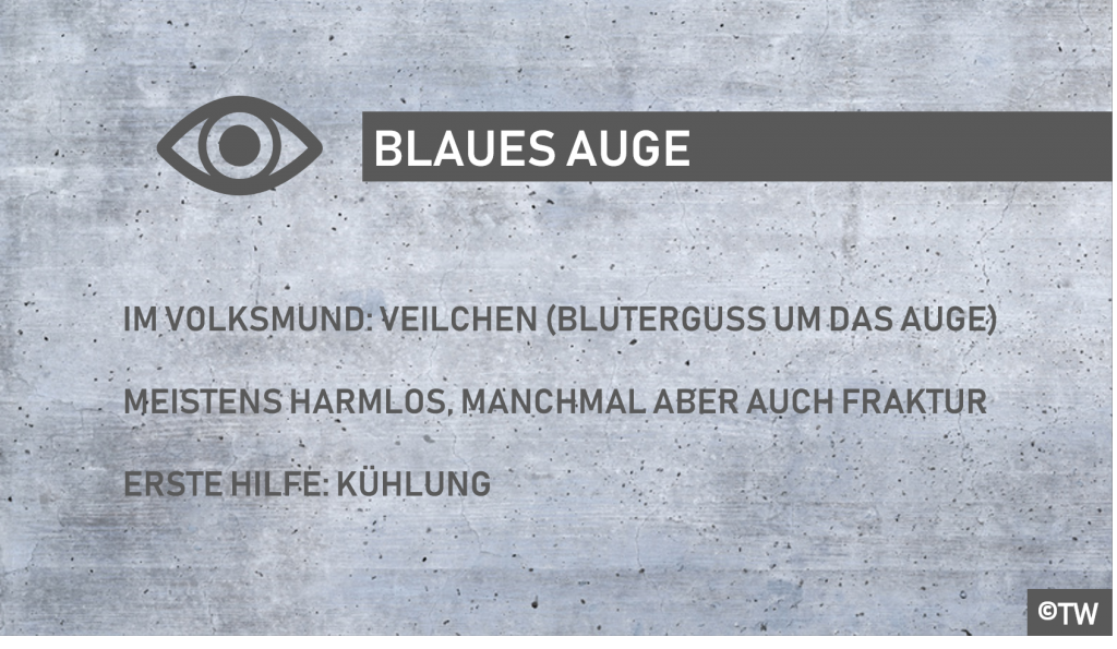 DoktorWeigl erklärt Das blaue Auge – das Veilchen