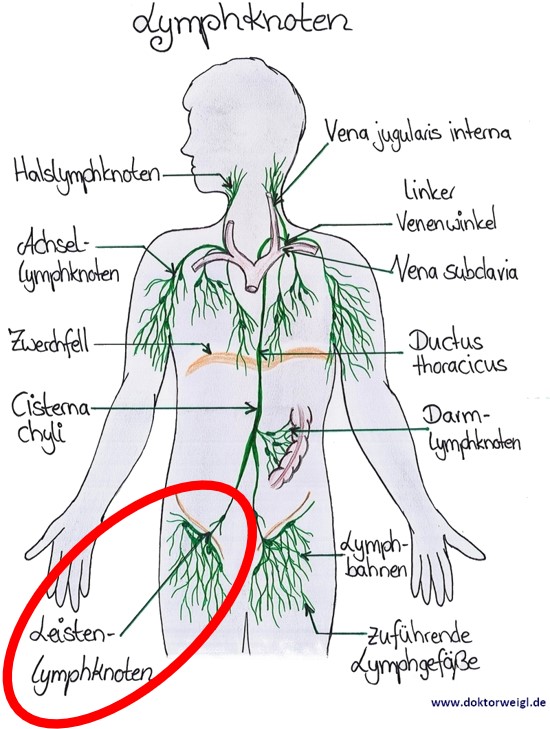 Verschiebbar lymphknoten Lymphknotenschwellung durch