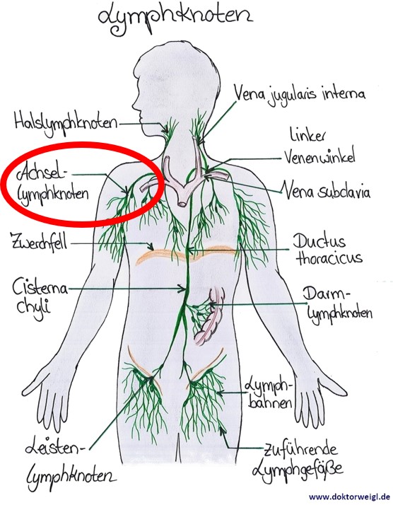 DoktorWeigl Erklärt Lymphknoten Achsel - Was Bedeuten Schwellung.