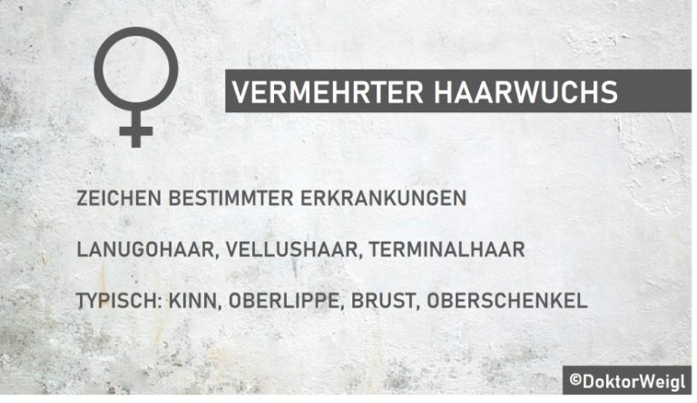 Dr. Dr. Tobias Weigl erklärt: Was ist vermehrter Haarwuchs?