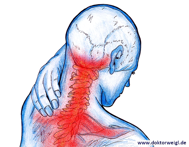 schmerzen an der halswirbelsäule symptome - www.listaso.com 