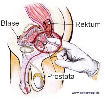 Von außen prostata So funktioniert