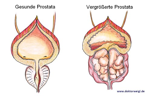 Volum normal prostata