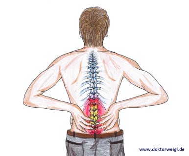 Rücken Rückenschmerzen